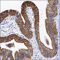 Light microscopy image of anti-PIR antibody validation by IHC on FFPE human bladder sections using diaminobenzidine (DAB) enzymatic detection (brown chromogen) and counterstaining with hematoxylin (blue).