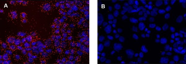 Detection of EGFR in cytospin preparations of A431 cells using Duolink® PLA