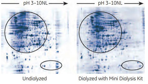 Effect of dialysis on 2-D resolution