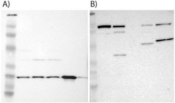 Examples of supportive WB images showing bands of predicted sizes in kDa (+/-20%) with additional bands present.