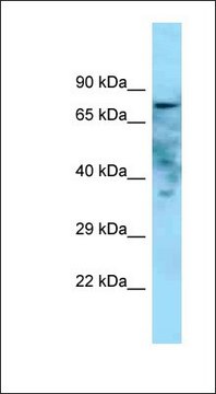 Anti-GOLIM4 antibody produced in rabbit affinity isolated antibody