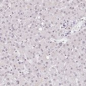 Anti-TCERG1 antibody produced in rabbit Prestige Antibodies® Powered by Atlas Antibodies, affinity isolated antibody, buffered aqueous glycerol solution