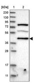 Anti-PDCD2 antibody produced in rabbit Prestige Antibodies® Powered by Atlas Antibodies, affinity isolated antibody, buffered aqueous glycerol solution