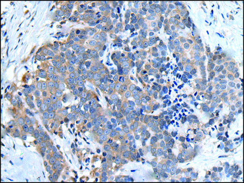 抗-UBQLN2 affinity isolated antibody