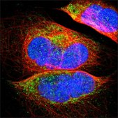 抗 SDHB 兔抗 Ab1, Prestige Antibodies® Powered by Atlas Antibodies, affinity isolated antibody, buffered aqueous glycerol solution