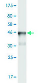 Monoclonal Anti-EPB41L3 antibody produced in mouse clone 1B7, purified immunoglobulin, buffered aqueous solution