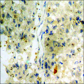 抗 磷酸化-Trk C (pTyr 516 ) 兔抗 affinity isolated antibody