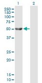Anti-GK antibody produced in mouse IgG fraction of antiserum, buffered aqueous solution