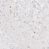 Monoclonal Anti-OTP antibody produced in mouse Prestige Antibodies® Powered by Atlas Antibodies, clone CL11222, purified immunoglobulin, buffered aqueous glycerol solution