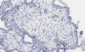 Anti-ZCCHC3 Antibody, clone 1E10 ZooMAb® Rabbit Monoclonal recombinant, expressed in HEK 293 cells