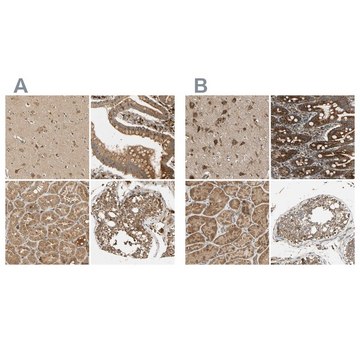 Anti-MRPS22 antibody produced in rabbit Prestige Antibodies&#174; Powered by Atlas Antibodies, affinity isolated antibody, buffered aqueous glycerol solution, Ab2