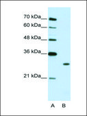 Anti-MBNL1 (AB2) antibody produced in rabbit IgG fraction of antiserum