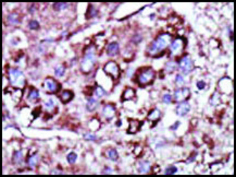 Anti-DGKZ (C-term) antibody produced in rabbit IgG fraction of antiserum, buffered aqueous solution