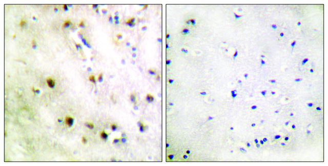 Anti-TISB antibody produced in rabbit affinity isolated antibody