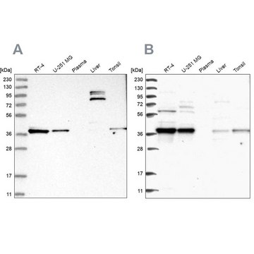 Anti-TBCC antibody produced in rabbit Prestige Antibodies&#174; Powered by Atlas Antibodies, affinity isolated antibody, buffered aqueous glycerol solution