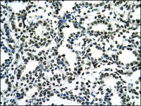 Anti-ZNF706 antibody produced in rabbit affinity isolated antibody