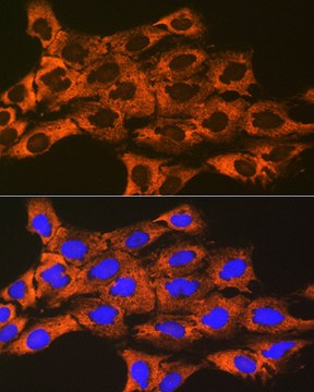 Anti-UQCRFS1 Antibody, clone 0O9Z10, Rabbit Monoclonal