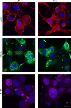 Monoclonal Anti-Neurofilament 160 antibody produced in mouse clone NN18, ascites fluid