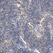 Anti-C5 antibody produced in rabbit Prestige Antibodies® Powered by Atlas Antibodies, affinity isolated antibody, buffered aqueous glycerol solution