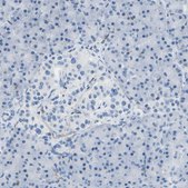 Anti-RCSD1 antibody produced in rabbit Prestige Antibodies® Powered by Atlas Antibodies, affinity isolated antibody, buffered aqueous glycerol solution
