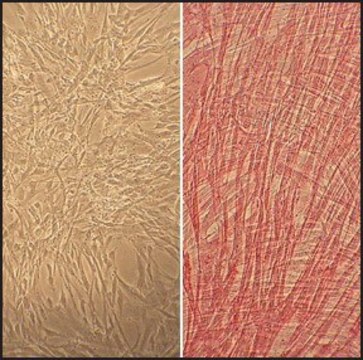 Human Umbilical Artery Smooth Muscle Cells: HUASMC, neonatal