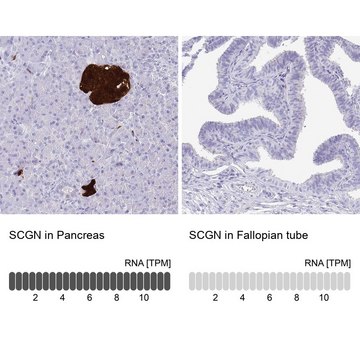 抗-SCGN 兔抗 affinity isolated antibody, buffered aqueous glycerol solution