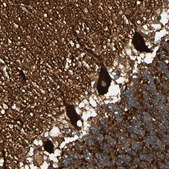 Anti-SPTAN1 antibody produced in rabbit Prestige Antibodies® Powered by Atlas Antibodies, affinity isolated antibody, buffered aqueous glycerol solution