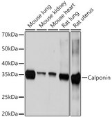 Anti-Calponin Antibody, clone 1E8M8, Rabbit Monoclonal