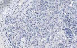 Anti-MDM2 Antibody, clone IF2 ZooMAb® Mouse Monoclonal recombinant, expressed in HEK 293 cells