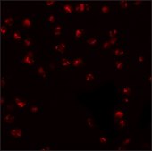 Anti-KPNA3 antibody produced in rabbit affinity isolated antibody, buffered aqueous solution