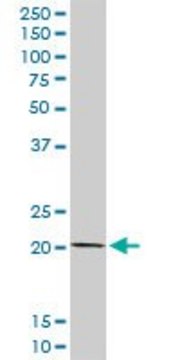 Anti-COMMD1 antibody produced in rabbit purified immunoglobulin, buffered aqueous solution