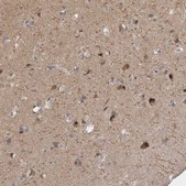 Anti-DLG2 antibody produced in rabbit Prestige Antibodies® Powered by Atlas Antibodies, affinity isolated antibody, buffered aqueous glycerol solution