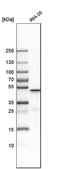 Anti-ACOT9 antibody produced in rabbit Prestige Antibodies® Powered by Atlas Antibodies, affinity isolated antibody, buffered aqueous glycerol solution