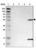 Anti-PIGS antibody produced in rabbit Prestige Antibodies® Powered by Atlas Antibodies, affinity isolated antibody, buffered aqueous glycerol solution