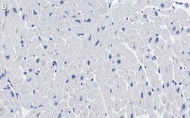 Anti-Laminin B2 Antibody, clone 1B9 ZooMAb® Rabbit Monoclonal recombinant, expressed in HEK 293 cells