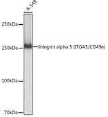 Anti-Integrin alpha 5 (ITGA5/CD49e) Antibody, clone 8F2O6, Rabbit Monoclonal
