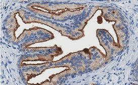 Anti-TMPRSS2 Antibody, clone 1B20 ZooMAb® Rabbit Monoclonal recombinant, expressed in HEK 293 cells