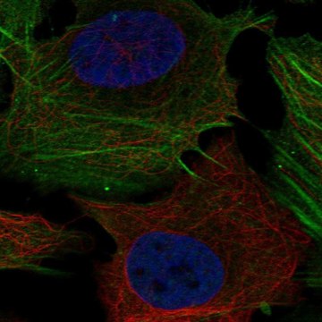 Anti-PHOSPHO1 antibody produced in rabbit Prestige Antibodies&#174; Powered by Atlas Antibodies, affinity isolated antibody