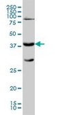 Monoclonal Anti-GALT antibody produced in mouse clone 4C11, purified immunoglobulin, buffered aqueous solution