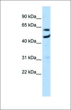 Anti-CNOT6 antibody produced in rabbit affinity isolated antibody