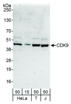 Rabbit anti-CDK9 Antibody, Affinity Purified Powered by Bethyl Laboratories, Inc.