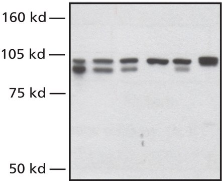 Anti-NBS1 (Nibrin) antibody produced in rabbit affinity isolated antibody, buffered aqueous solution