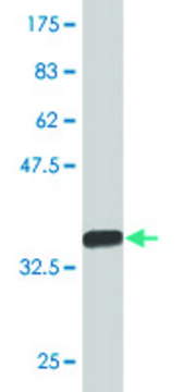 Monoclonal Anti-MAGEA1 antibody produced in mouse clone 3H5, purified immunoglobulin, buffered aqueous solution