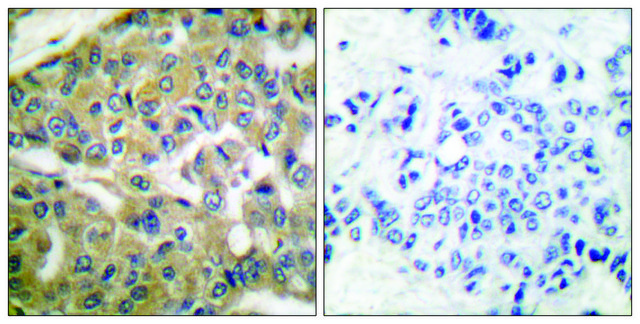 Anti-FHIT antibody produced in rabbit affinity isolated antibody