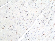 Anti-ANO1 / DOG1 / TMEM16A Rabbit Monoclonal Antibody clone RM440, affinity purified immunoglobulin