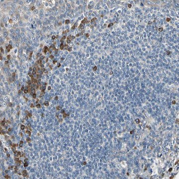 Anti-SELENOK antibody produced in rabbit Prestige Antibodies&#174; Powered by Atlas Antibodies, affinity isolated antibody, buffered aqueous glycerol solution