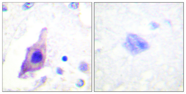 Anti-CDC25B antibody produced in rabbit affinity isolated antibody