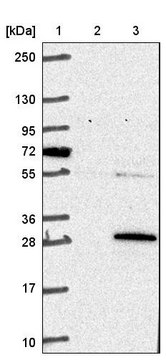 Anti-COMMD3 antibody produced in rabbit Prestige Antibodies&#174; Powered by Atlas Antibodies, affinity isolated antibody, buffered aqueous glycerol solution