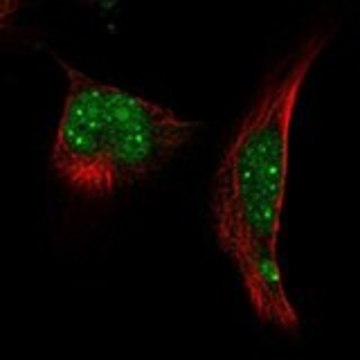 Anti-RNF4 antibody produced in rabbit Prestige Antibodies&#174; Powered by Atlas Antibodies, affinity isolated antibody, buffered aqueous glycerol solution