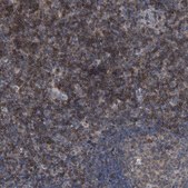 Anti-CD200 antibody produced in rabbit Prestige Antibodies® Powered by Atlas Antibodies, affinity isolated antibody, buffered aqueous glycerol solution